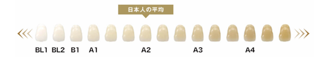 歯の色の日本人の平均