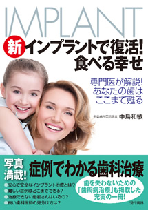 新インプラントで復活!食べる幸せ
